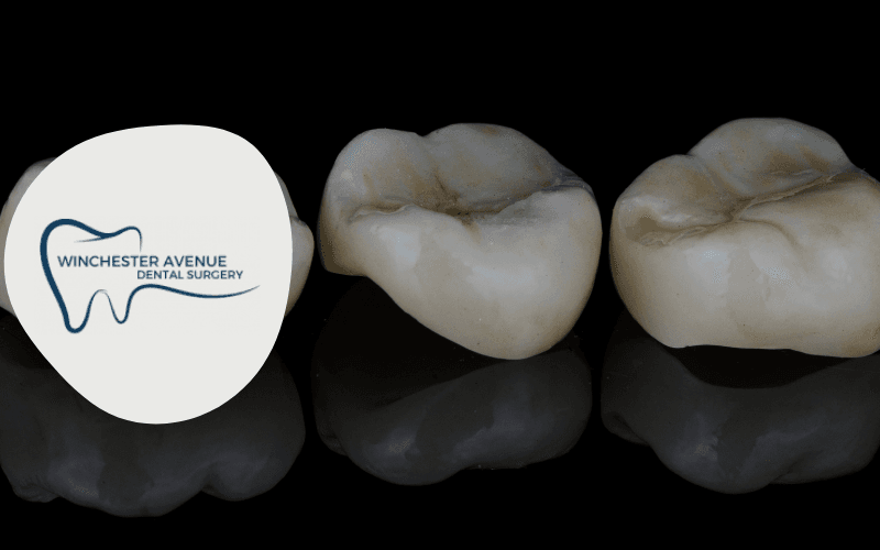 how long do dental crowns last