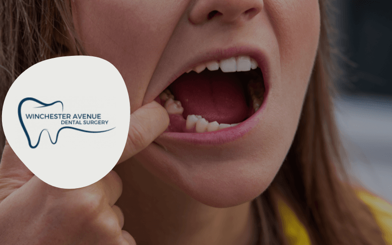 how long does it take for a pulled tooth to heal - cover photo