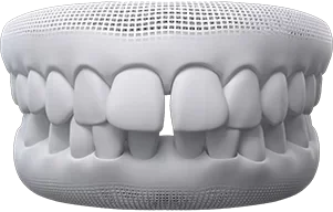 gaps