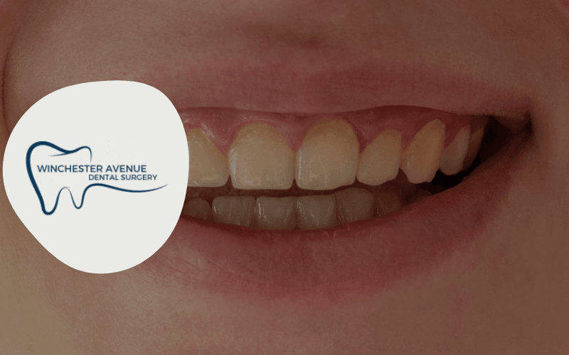yellow stains on teeth - dental blog