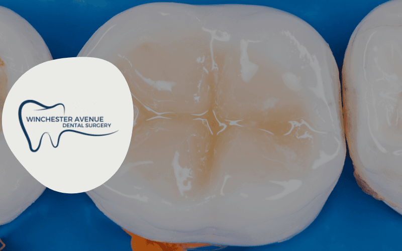 why does my tooth filling hurt after months - photo why does my tooth filling hurt after months - photo