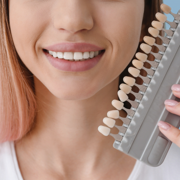 veneers in leiceste winchester avenue dental